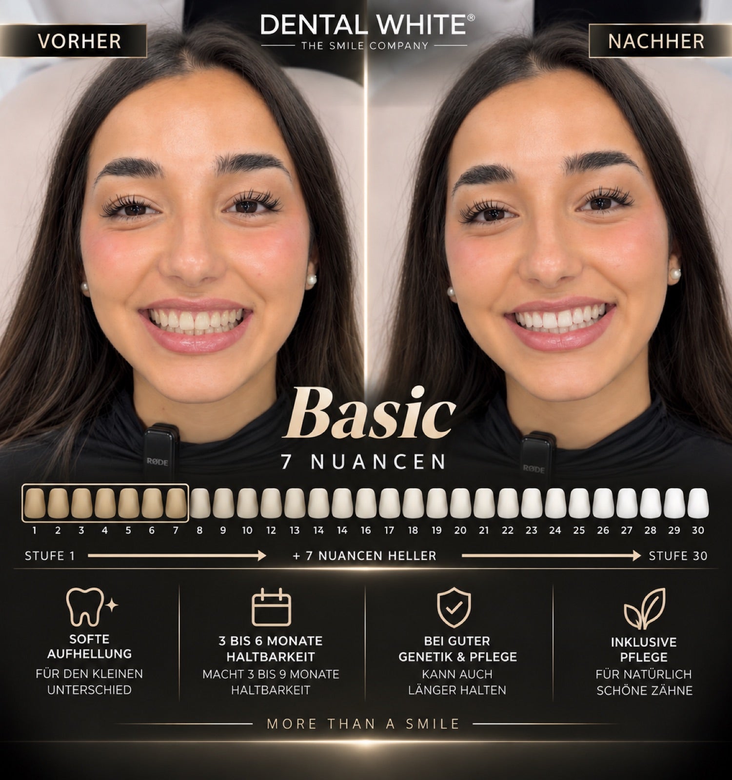 Basic Paket Vorher Nachher — 7 Nuancen heller