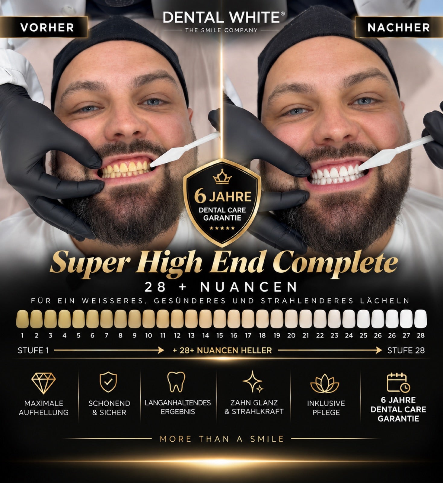 Super High End Complete Vorher Nachher — 28 Nuancen heller