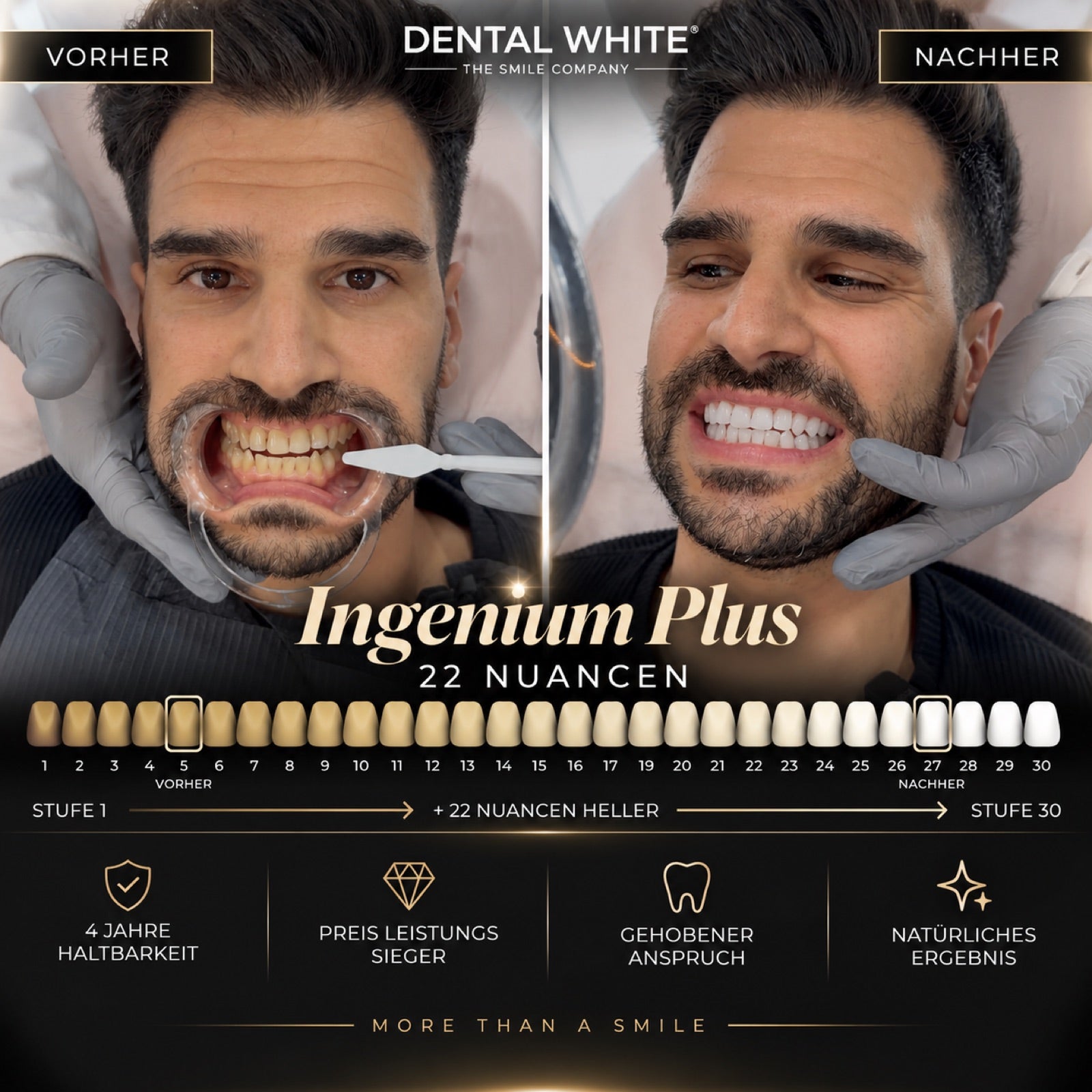 Ingenium Plus Vorher Nachher — 22 Nuancen heller